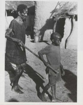 Individuals who have become blind due to onchocerciasis (river blindness) are commonly led by young people. The disease is among the leading causes of preventable blindness in the world. Ivermectin was approved for human use against river blindness in 1987.Courtesy Merck.