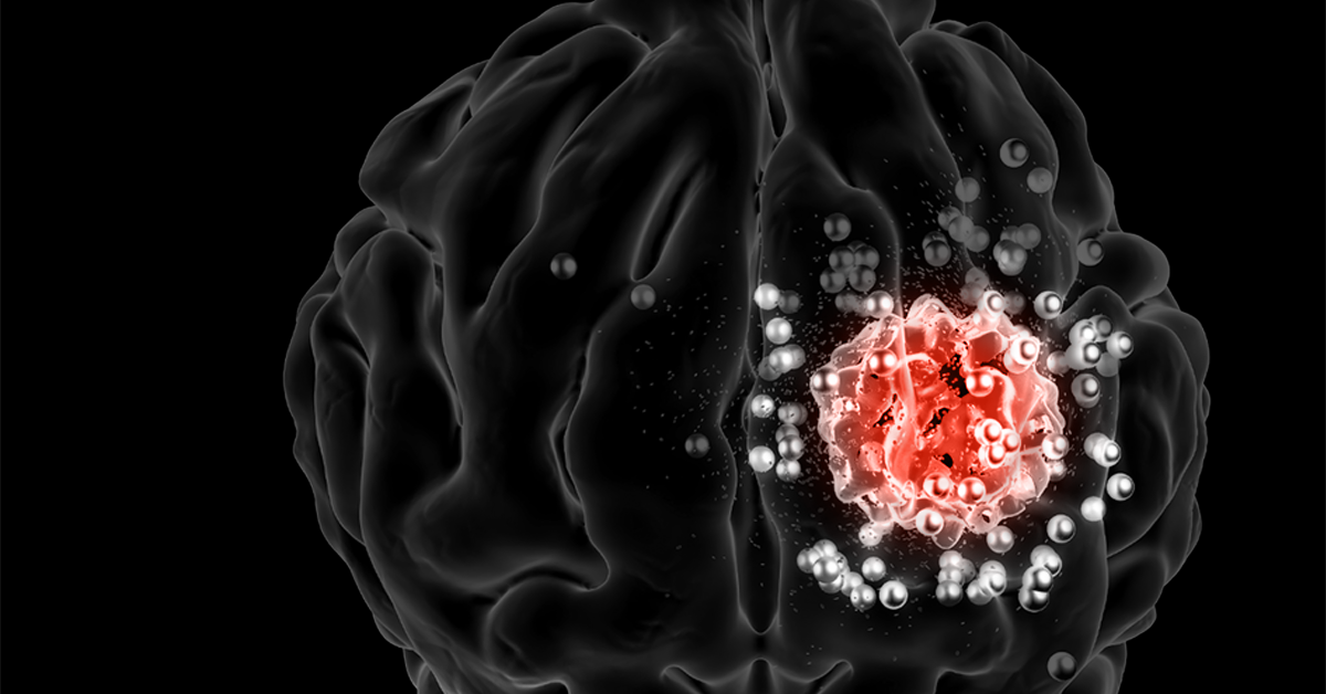 Digital illustration of a human brain with a highlighted area in red and white, possibly representing activity or a neurological condition.