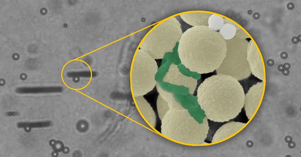 Magnified view of spherical bacteria in yellow with green rod-shaped bacteria on a gray background, highlighted by a circular inset.
