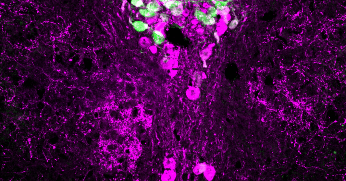 A vivid microscopic image showing neural cells in purple and green, highlighting distinct cell types and structures in brain tissue.