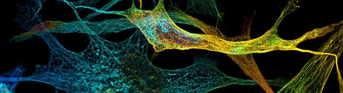 Abstract image of colorful, web-like structures in blue, yellow, and green on a black background.
