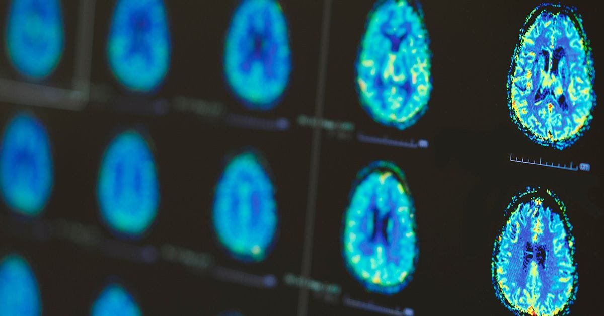A series of brain scan images displayed in a grid, showing various sections and activity levels in vibrant colors.