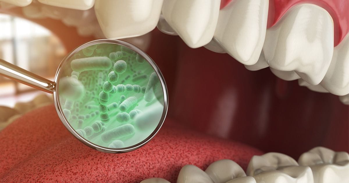 Magnified view of bacteria on the tongue inside an open mouth with visible teeth.