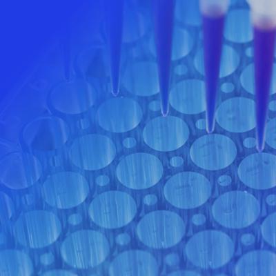 Close-up of a micropipette dispensing liquid into a blue microplate with multiple circular wells.