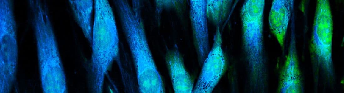 Recent Advances in Biomaterials Research in the East Asia Pacific Region