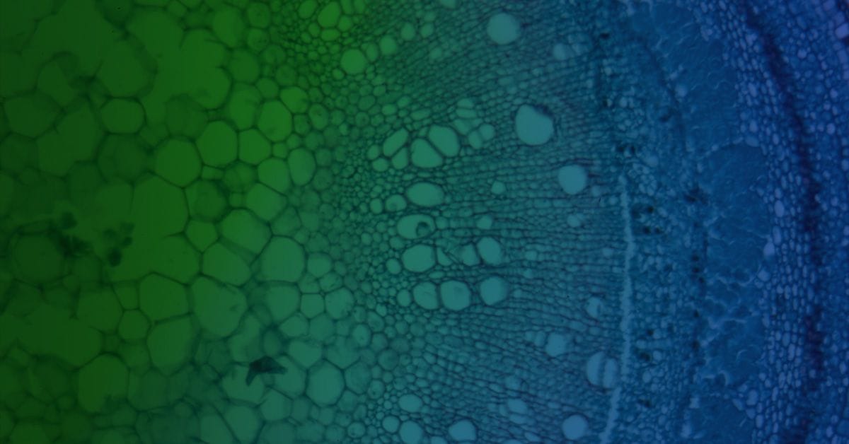 Microscopic view of plant cells showing chloroplasts in various shades of green and blue.