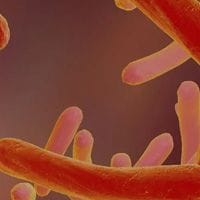 a close-up of tuberculosis bacteria in shades of red and orange